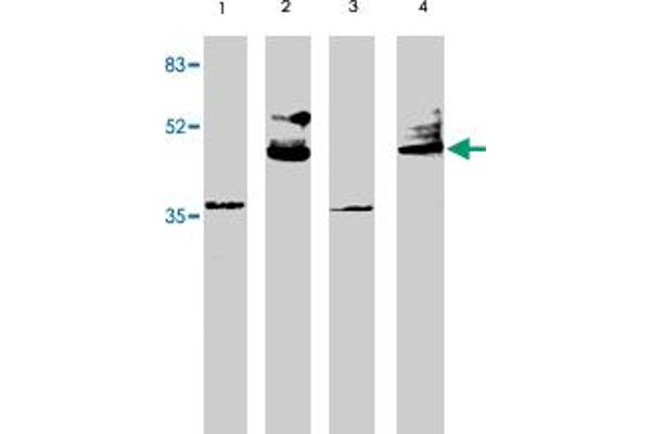 VSX2 anticorps  (AA 264-361)