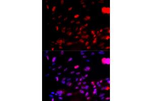 Immunofluorescence (IF) image for anti-Checkpoint Kinase 1 (CHEK1) (pSer317) antibody (ABIN1870071) (CHEK1 antibody  (pSer317))