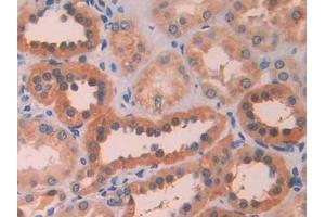 IHC-P analysis of Human Kidney Tissue, with DAB staining. (LOXL4 antibody  (AA 399-552))