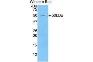Western blot analysis of the recombinant protein. (Peroxiredoxin 1 antibody  (AA 1-199))