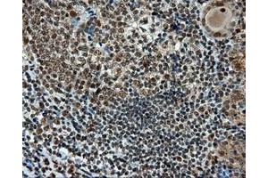 Immunohistochemical staining of paraffin-embedded Kidney tissue using anti-RC211175 mouse monoclonal antibody. (TUBA8 antibody)