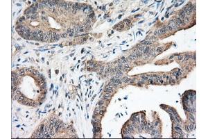 Immunohistochemistry (IHC) image for anti-Nucleoredoxin-Like 2 (NXNL2) antibody (ABIN1499887) (NXNL2 antibody)
