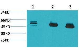 Western Blotting (WB) image for anti-Mitochondrial Calcium Uptake 1 (MICU1) antibody (ABIN3179096) (MICU1 antibody)