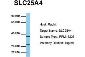 Host: Rabbit Target Name: SLC25A4 Sample Tissue: Human RPMI-8226 Antibody Dilution: 1. (SLC25A4 antibody  (N-Term))