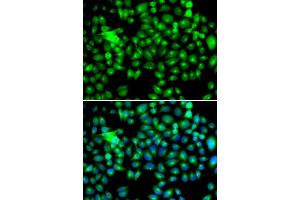 Immunofluorescence (IF) image for anti-Heat Shock 22kDa Protein 8 (HSPB8) (AA 1-196) antibody (ABIN6219596) (HSPB8 antibody  (AA 1-196))