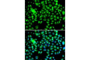 Immunofluorescence (IF) image for anti-Heat Shock 22kDa Protein 8 (HSPB8) (AA 1-196) antibody (ABIN3016167) (HSPB8 antibody  (AA 1-196))
