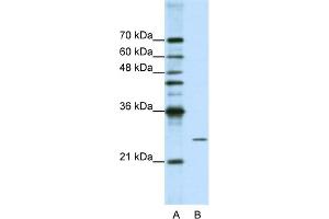 WB Suggested Anti-POP4 Antibody Titration:  1. (RPP29 antibody  (C-Term))