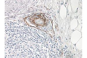 Image no. 1 for anti-Nerve Growth Factor (NGF) antibody (ABIN465644) (Nerve Growth Factor antibody)