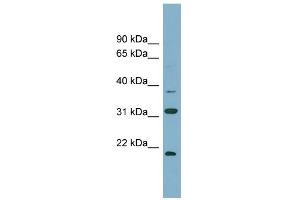 WB Suggested Anti-N6AMT1 Antibody Titration:  0. (N6AMT1 antibody  (N-Term))