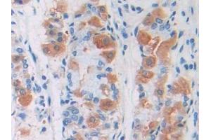 Detection of Pgp in Human Stomach Tissue using Polyclonal Antibody to Permeability Glycoprotein (Pgp)