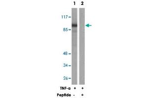 Western blot analysis of extracts from HeLa cells, treated with TNF-a (20 ng/mL, 30 mins), using PLA2G4A polyclonal antibody . (PLA2G4A antibody)