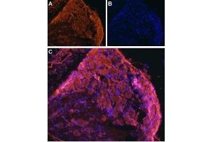 Expression of ENT1 in rat DRG - Immunohistochemical staining of rat frozen dorsal root ganglion (DRG) using Anti-ENT1 (SLC29A1) Antibody (ABIN7043710 and ABIN7044800), (1:100), followed by goat anti-rabbit-AlexaFluor- 555 secondary antibody.