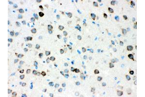 Anti- ATX2 Picoband antibody, IHC(P) IHC(P): Mouse Brain Tissue (Ataxin 2 antibody  (C-Term))
