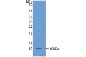 Detection of Recombinant S100A12, Human using Monoclonal Antibody to S100 Calcium Binding Protein A12 (S100A12) (S100A12 antibody  (AA 1-92))