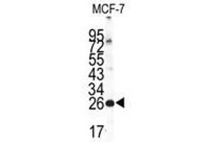 Image no. 1 for anti-Neuronal Calcium Sensor 1 (NCS1) (Center) antibody (ABIN357105) (NCS1 antibody  (Center))