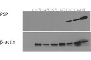 Western Blotting (WB) image for anti-Syntaxin Binding Protein 3 (STXBP3) (AA 146-160), (Internal Region) antibody (ABIN1108779)