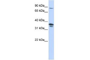 SLCO3A1 antibody used at 1 ug/ml to detect target protein. (Solute Carrier Organic Anion Transporter Family, Member 3A1 (SLCO3A1) (Middle Region) antibody)
