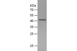 Western Blotting (WB) image for ClpP Caseinolytic Peptidase, ATP-Dependent, Proteolytic Subunit Homolog (E. Coli) (CLPP) (AA 66-277) protein (His-IF2DI Tag) (ABIN7283700) (CLPP Protein (AA 66-277) (His-IF2DI Tag))