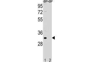 Western Blotting (WB) image for anti-Family with Sequence Similarity 26, Member F (FAM26F) antibody (ABIN3004478) (FAM26F antibody)