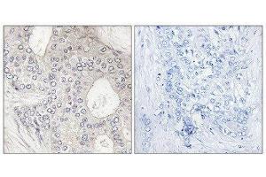 Immunohistochemistry (IHC) image for anti-Cytochrome P450, Family 1, Subfamily A, Polypeptide 2 (CYP1A2) (Internal Region) antibody (ABIN1850336) (CYP1A2 antibody  (Internal Region))