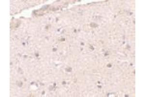 Immunohistochemistry of BRCC36 in human brain tissue with BRCC36 antibody at 2. (BRCC3 antibody  (N-Term))