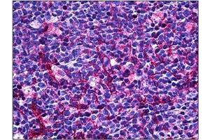 Immunohistochemistry (Paraffin-embedded Sections) (IHC (p)) image for anti-Platelet/endothelial Cell Adhesion Molecule (PECAM1) (C-Term) antibody (ABIN784194)