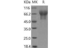 Western Blotting (WB) image for Cell Adhesion Molecule 1 (CADM1) (AA 1-377) protein (His tag) (ABIN7195011) (CADM1 Protein (AA 1-377) (His tag))