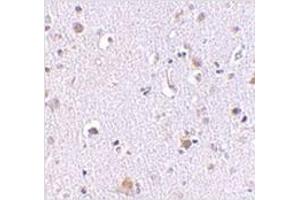 Immunohistochemistry of NUP160 in human brain tissue with NUP160 antibody at 2. (NUP160 antibody  (C-Term))