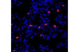 Immunofluorescence of paraffin embedded mouse lung using IL-23R (ABIN7074355) at dilution of 1:200 (400x lens) (IL23R antibody)