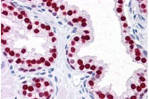 Human Prostate: Formalin-Fixed, Paraffin-Embedded (FFPE) (FOXA1 antibody  (AA 367-473))