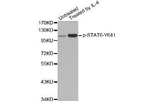 Western Blotting (WB) image for anti-Signal Transducer and Activator of Transcription 6, Interleukin-4 Induced (STAT6) (pTyr641) antibody (ABIN1870652) (STAT6 antibody  (pTyr641))