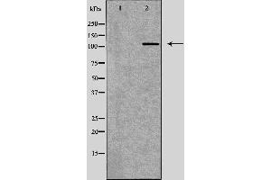 Western blot analysis of heart tissue  lysate using ATP2A2 antibody. (ATP2A2 antibody  (Internal Region))