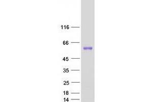 Western Blotting (WB) image for Tubulin Folding Cofactor E-Like (TBCEL) (Transcript Variant 2) protein (Myc-DYKDDDDK Tag) (ABIN2733295)