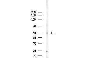 anti-Regulator of Chromosome Condensation (RCC1) and BTB (POZ) Domain Containing Protein 1 (RCBTB1) (Internal Region) antibody