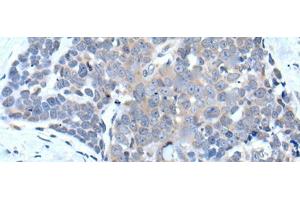 Immunohistochemistry (Paraffin-embedded Sections) (IHC (p)) image for anti-Vacuolar Protein Sorting 35 (VPS35) antibody (ABIN7248266)