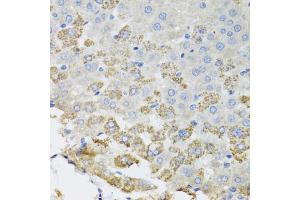 Immunohistochemistry of paraffin-embedded rat liver using TROVE2 antibody (ABIN2560570) at dilution of 1:100 (40x lens). (TROVE2 antibody)