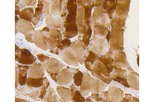 Paraformaldehyde-fixed, paraffin embedded mouse skeletal muscle, Antigen retrieval by boiling in sodium citrate buffer (pH6) for 15min, Block endogenous peroxidase by 3% hydrogen peroxide for 30 minutes, Blocking buffer at 37°C for 20min, Antibody incubation with Glycogen synthase 1(S641) (10C1) Monoclonal Antibody  at 1:50 overnight at 4°C, followed by a conjugated secondary and DAB staining. (Glycogen Synthase 1 antibody  (pSer641))