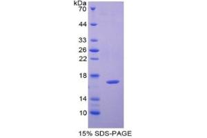SDS-PAGE of Protein Standard from the Kit (Highly purified E. (CAP2 ELISA Kit)