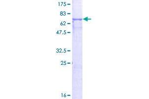 Image no. 1 for Glycoprotein A33 (Transmembrane) (GPA33) (AA 1-319) protein (GST tag) (ABIN1355505)