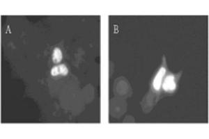 Image no. 1 for anti-Dual-Specificity tyrosine-(Y)-phosphorylation Regulated Kinase 1A (DYRK1A) (AA 486-763) antibody (ABIN297140) (DYRK1A antibody  (AA 486-763))