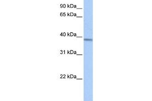 Western Blotting (WB) image for anti-Acyl-CoA Dehydrogenase, Short/branched Chain (ACADSB) antibody (ABIN2459779) (ACADSB antibody)