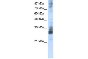 WB Suggested Anti-RG9MTD2 Antibody Titration:  2. (RG9MTD2 antibody  (Middle Region))