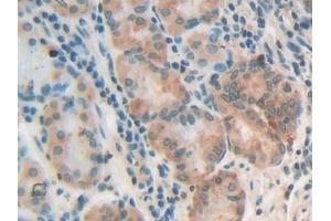 IHC-P analysis of Human Stomach Tissue, with DAB staining. (NG2 antibody  (AA 1705-1942))