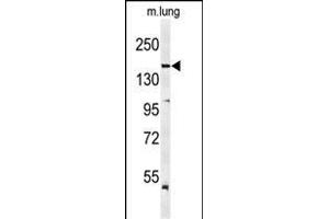 Western blot analysis of KDR  Antibody (ABIN652371 and ABIN2841771) in mouse lung tissue lysates (35 μg/lane). (VEGFR2/CD309 antibody  (Tyr1175))
