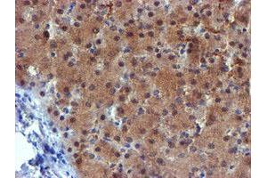 Image no. 8 for anti-Mannose Phosphate Isomerase (MPI) antibody (ABIN1499545) (MPI antibody)