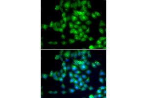 Immunofluorescence analysis of MCF-7 cells using SIRT3 antibody.