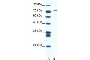 Human Jurkat; WB Suggested Anti-CXORF6 Antibody Titration: 1.