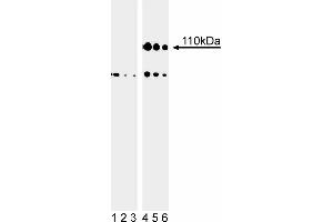 Western blot analysis of Rb (pS807/pS811) in human embryonic skin cells. (Retinoblastoma 1 antibody  (pSer807))
