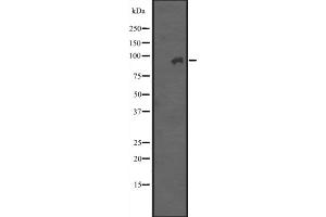 Western blot analysis of ITGB7 expression in A431 whole cell lysate ,The lane on the left is treated with the antigen-specific peptide. (Integrin beta 7 antibody  (Internal Region))