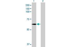 Western Blot analysis of MEIS2 expression in transfected 293T cell line by MEIS2 MaxPab polyclonal antibody. (MEIS2 antibody  (AA 1-470))